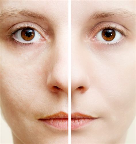<b>מטשטש גם את הפגמים החזקים (צילום: shutterstock)</b>